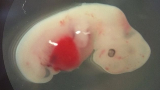 embryo
